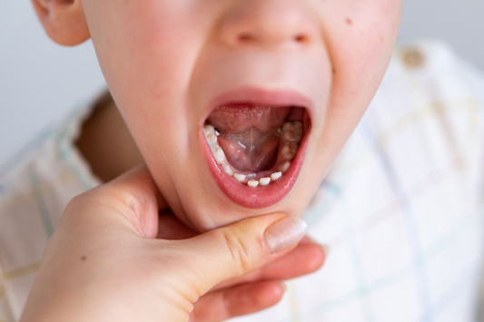 子供の歯並びは6歳〜10歳頃で決まる!噛むことの重要性とは?